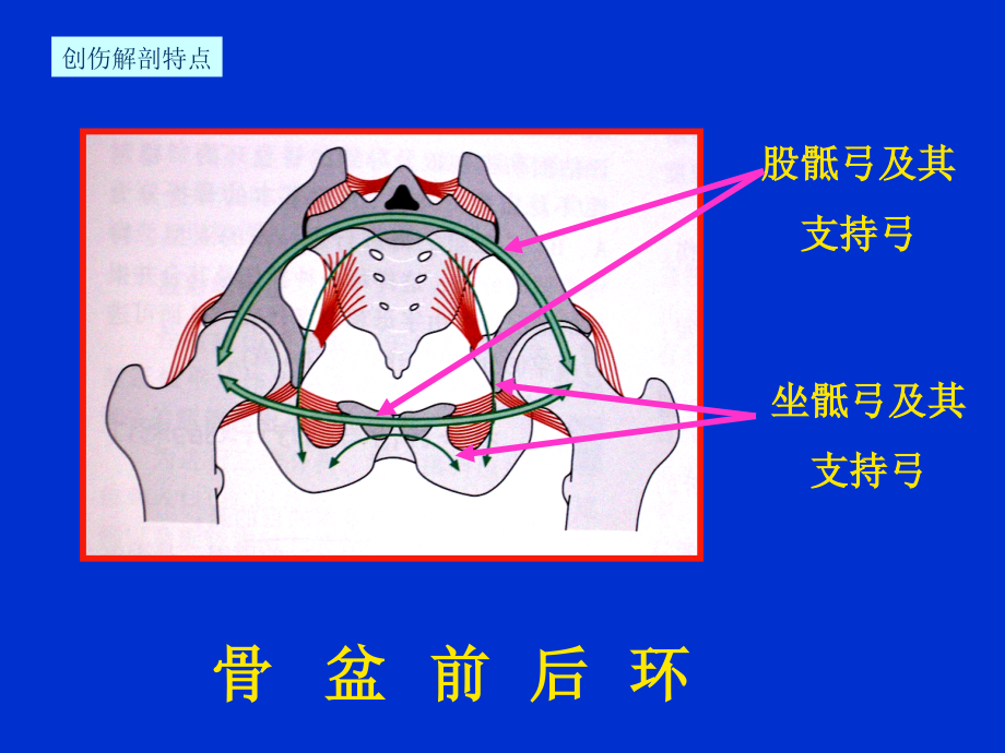 骨盆骨折急诊处理一般原则_第4页