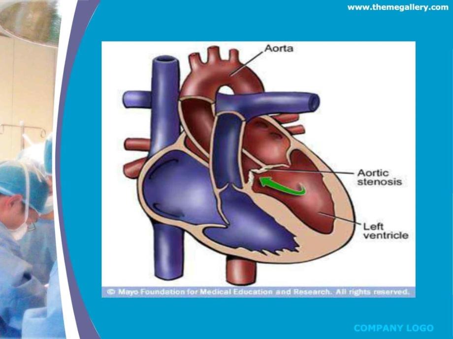心脏外科手术配合课件_第2页