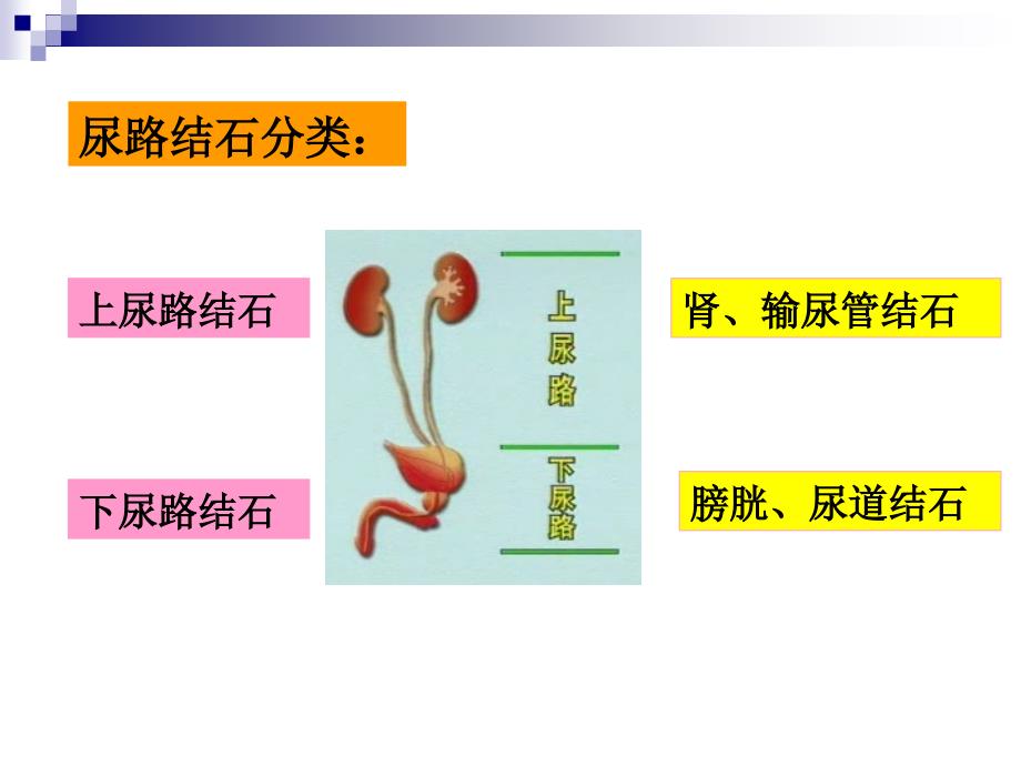 尿石症病人的护理_1课件_第4页