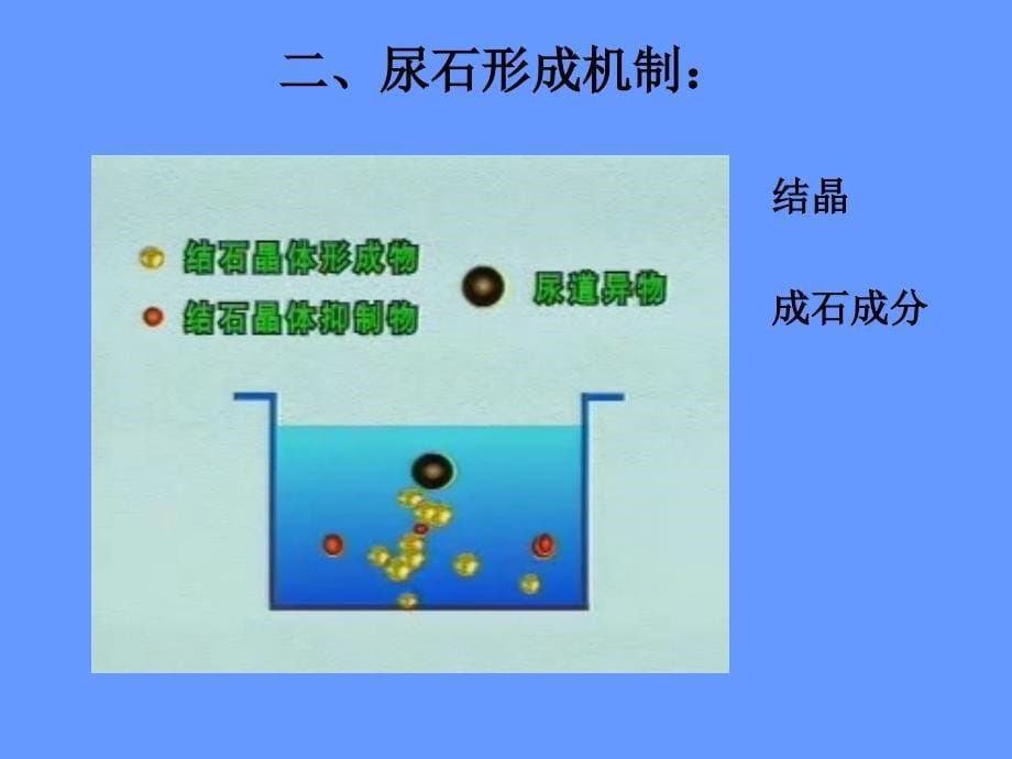 尿石症病人的护理_1课件_第5页