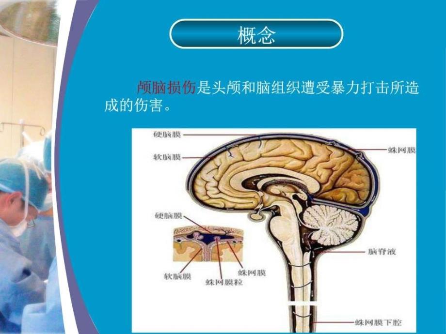 重型颅脑损伤护理查房图文课件_第4页