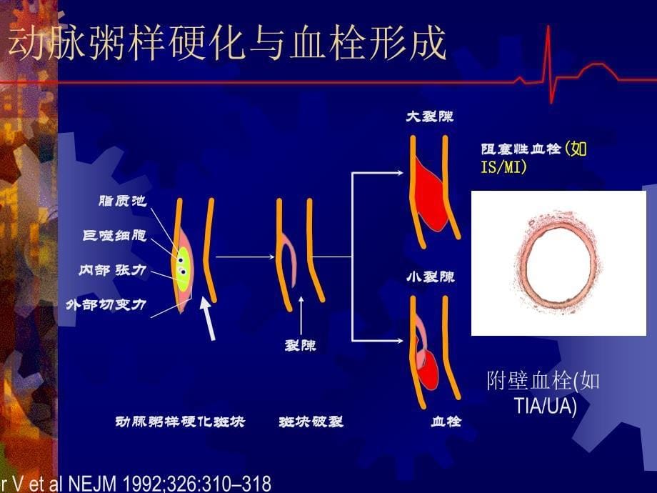 抗血小板药和抗凝药的临床公道应用整理版课件_第5页