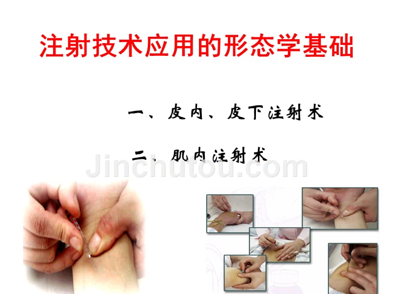 注射技术应用解剖ppt课件_第1页