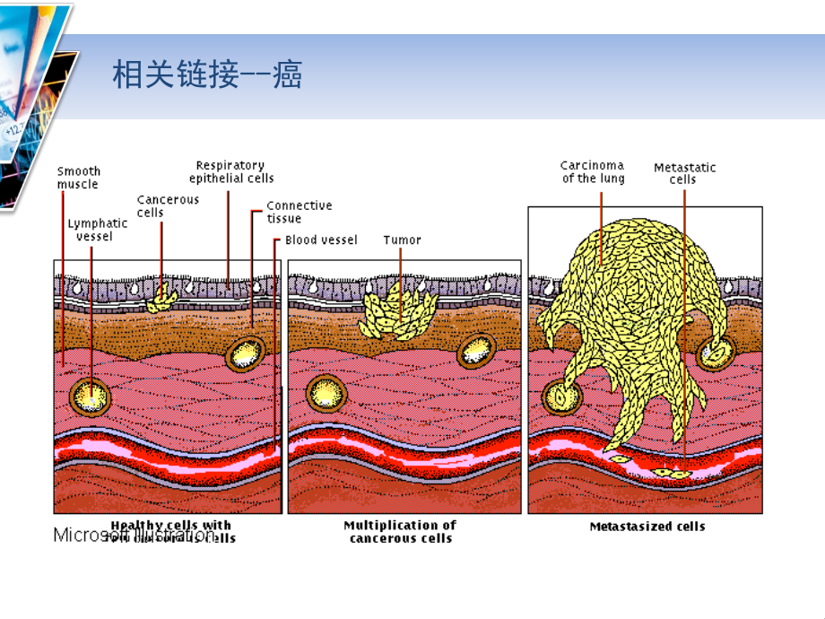 分子靶向药物分子靶向组织靶向器官靶向常规化疗肿瘤分子靶向治疗课件_第4页