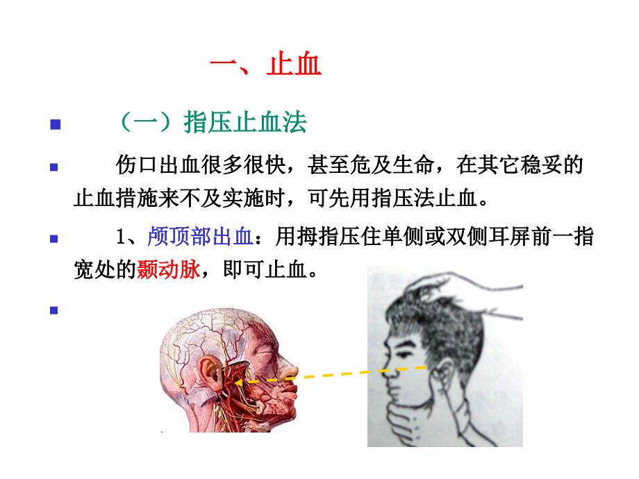 创伤现场急救的四项基本技术解析课件_第3页