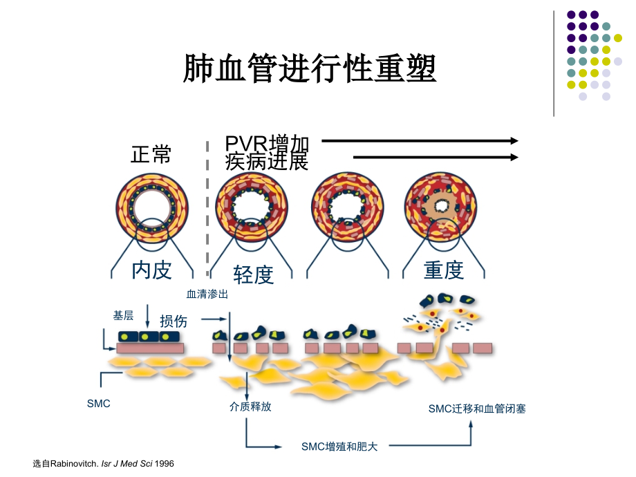 阜外教授肺动脉高压靶向药物治疗的研究进展资料课件_第3页