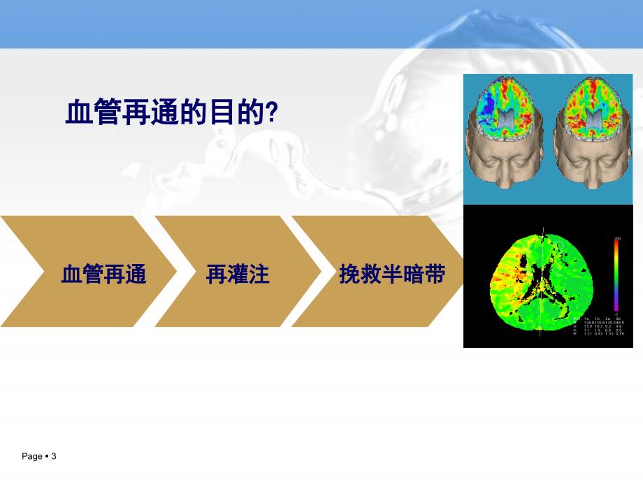 急性缺血性卒中血管再通策略研究与进展_1课件_第3页