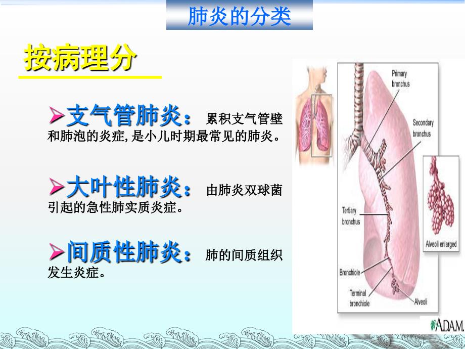 小儿肺炎护理ppt课件_第4页