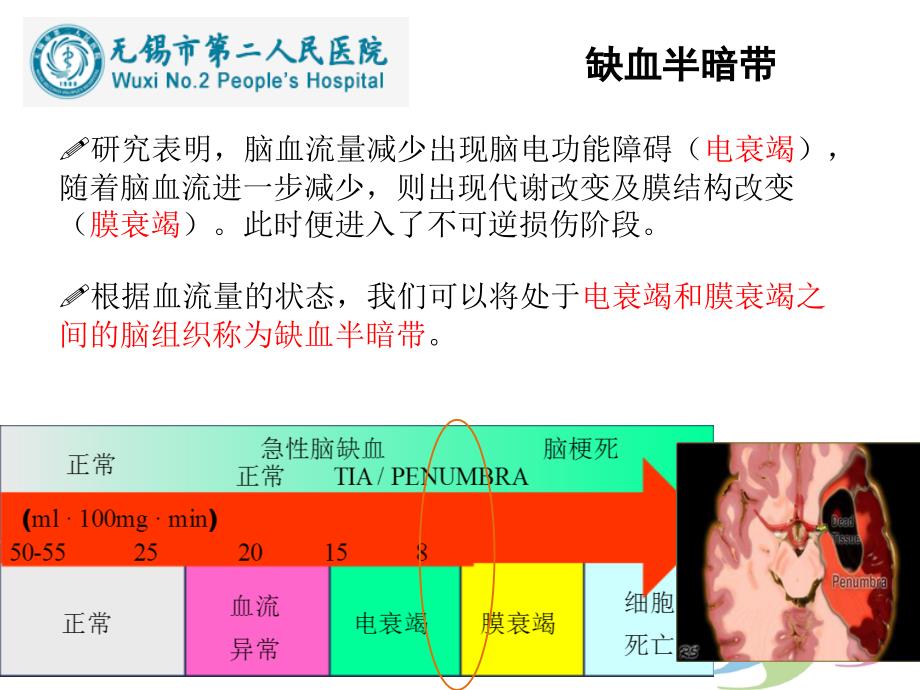 缺血性卒中影像学新进展 ppt课件_第2页