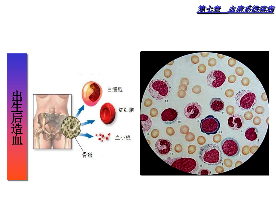 临床医学概要16血液系统疾病（课件）_第3页