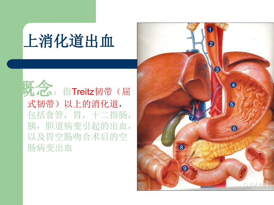 上消化道出血护理查房2015_1课件_第4页