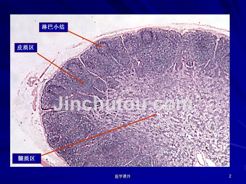 《病理学》实验内分泌 淋巴造血 神经系统 ppt课件_第2页