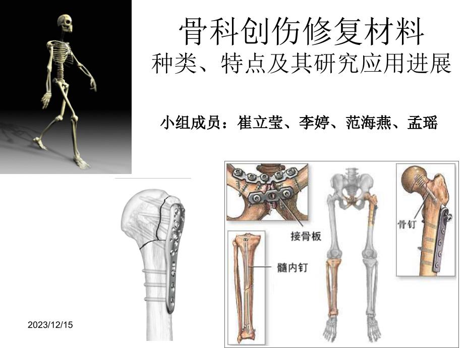 骨科创伤修复材料的种类特点及其研究应用1ppt课件_第1页