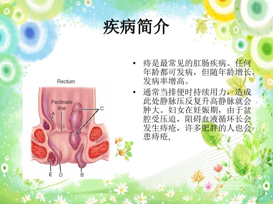 痔疮手术的护理_2课件_第3页