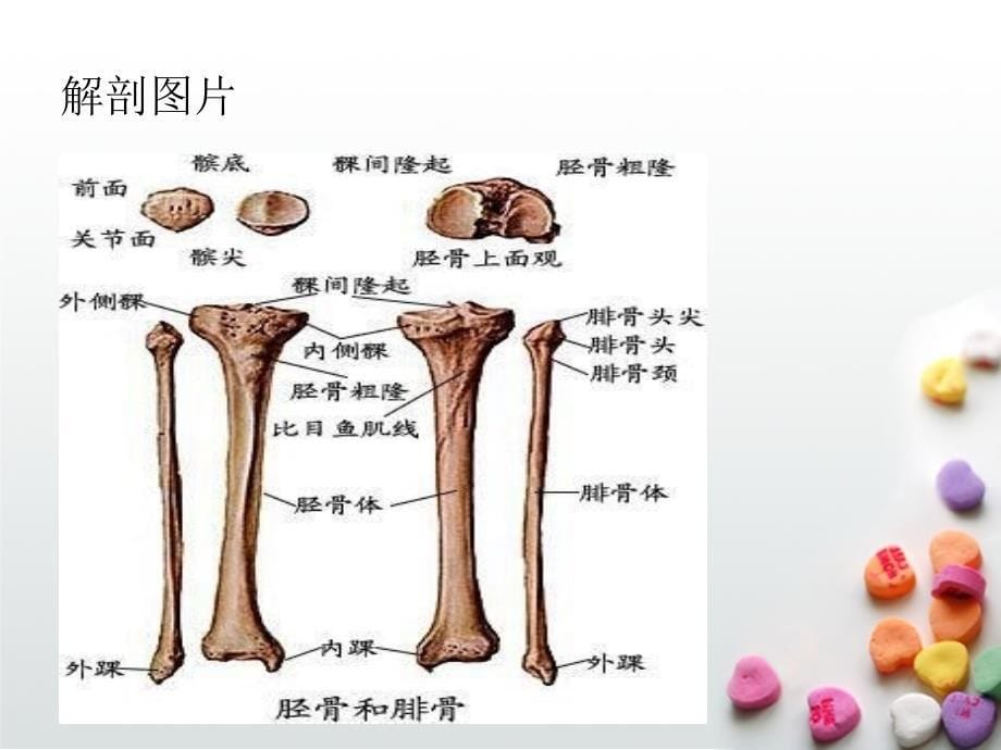 胫腓骨骨折_6课件_第5页