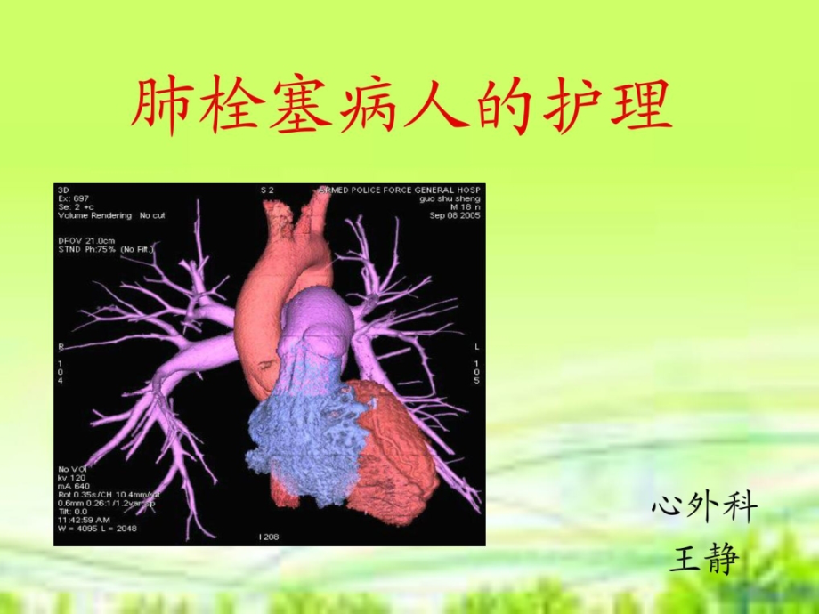 肺栓塞病人的护理_2课件_第1页