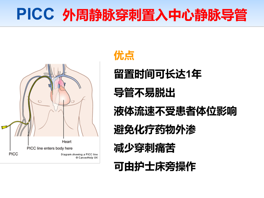 导管规范化维护 ppt课件_第2页