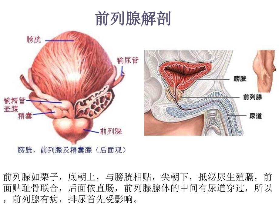 泌尿系统经典教学（南方医院）前列腺炎课件_第3页