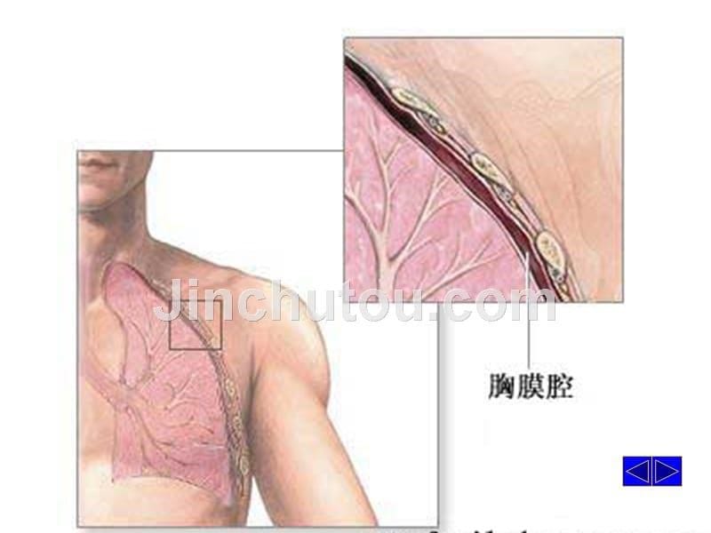 胸腔积液医学课件  116页_第5页