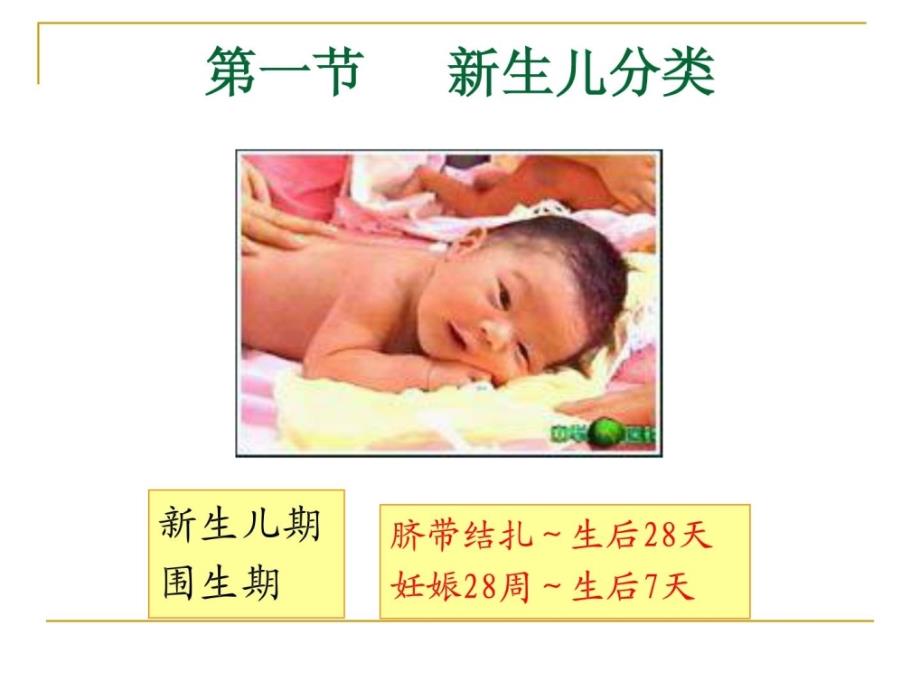 新生儿与新生儿疾病患儿的护理图文课件 (2)_第2页