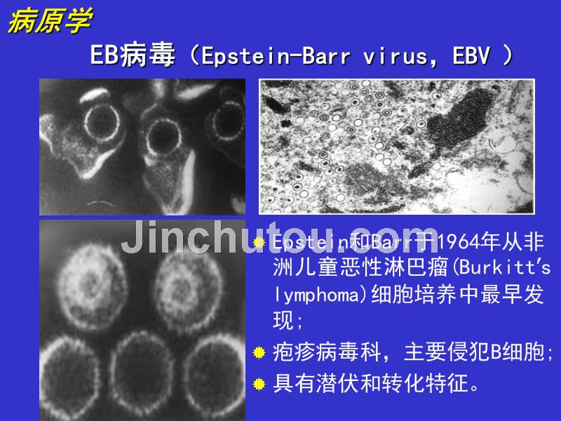 病毒相关性传染性单核细胞增多症 （2）图文课件_第4页