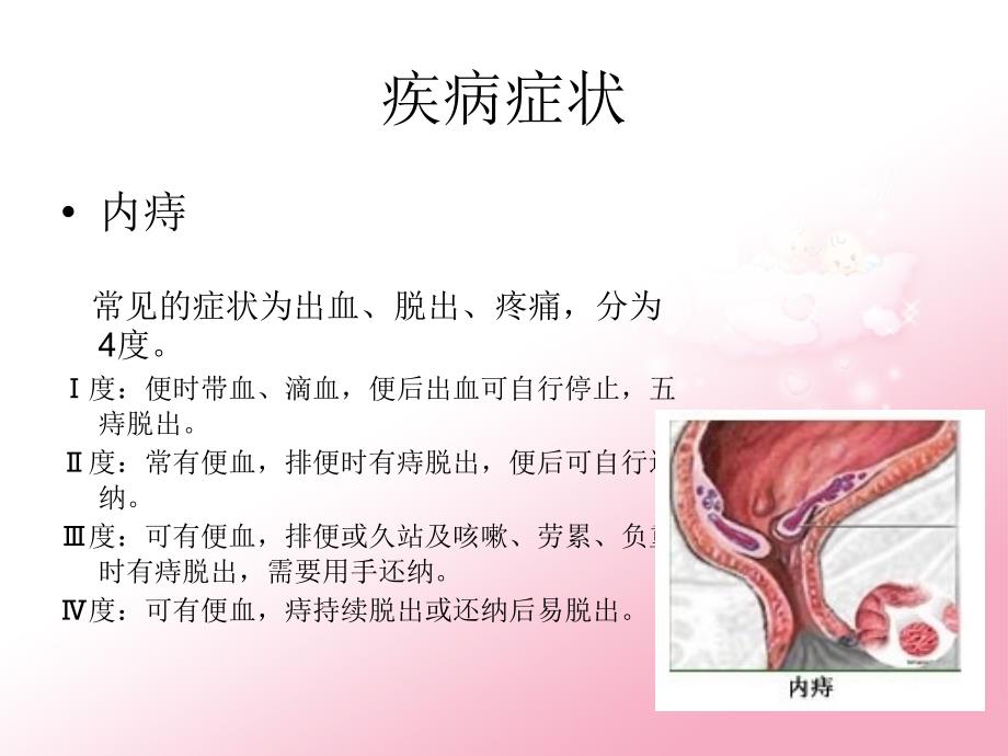 痔疮手术的护理课件_第4页