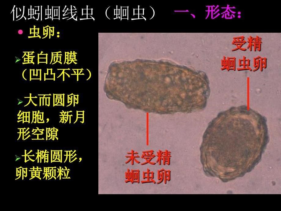 寄生虫检验2线虫纲1ppt课件_第5页