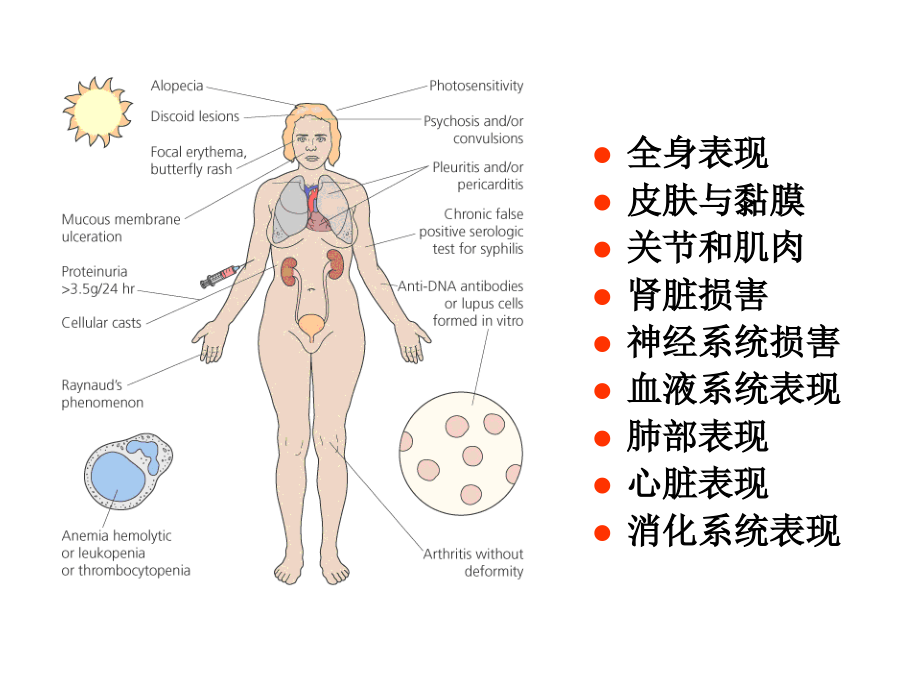 糖皮质激素在风湿病中的合理应用 （2）ppt课件_第3页