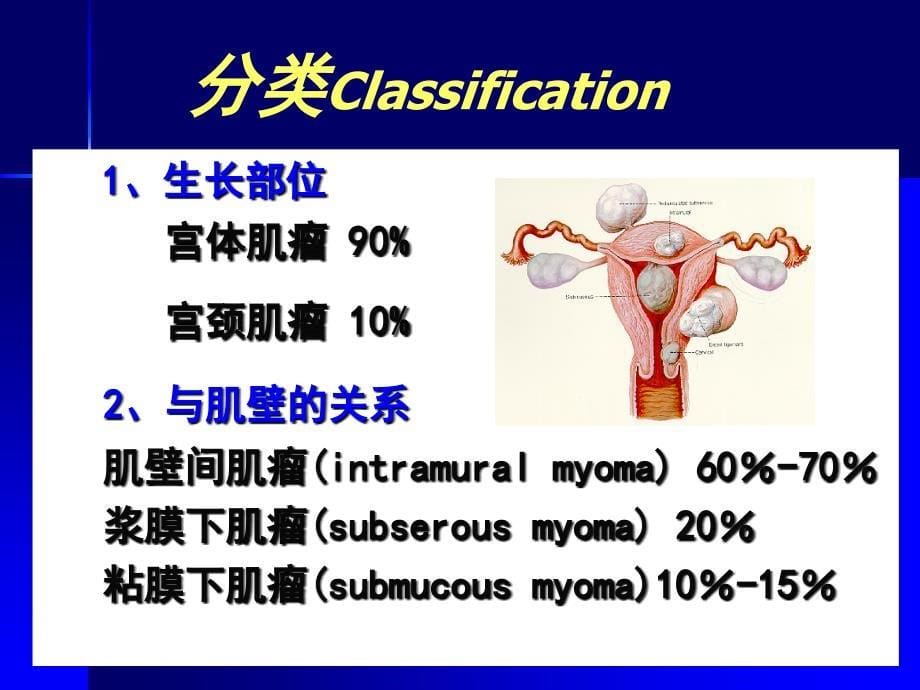 妊娠合并子宫肿瘤诊治课件_第5页