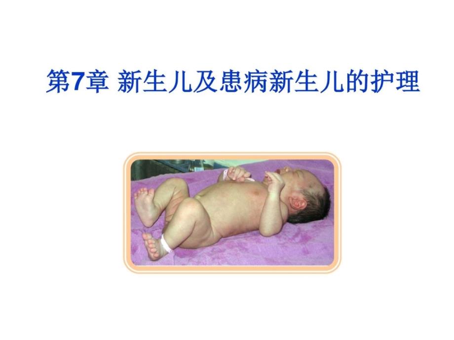 新生儿及患病新生儿的护理护理专业课件_第2页