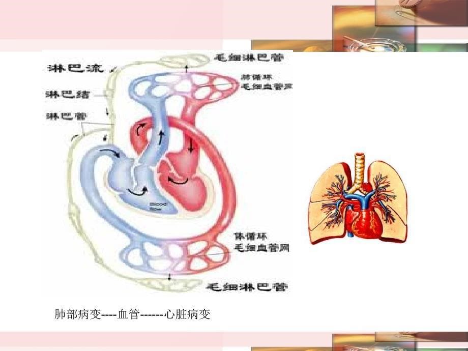 慢阻肺健康宣教ppt课件_第5页