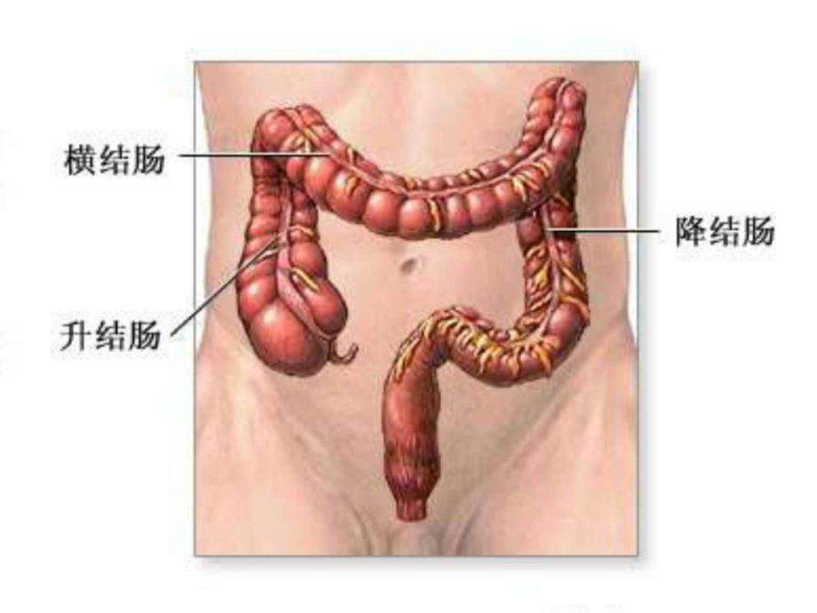 结肠癌（外科学课件）_1_第2页