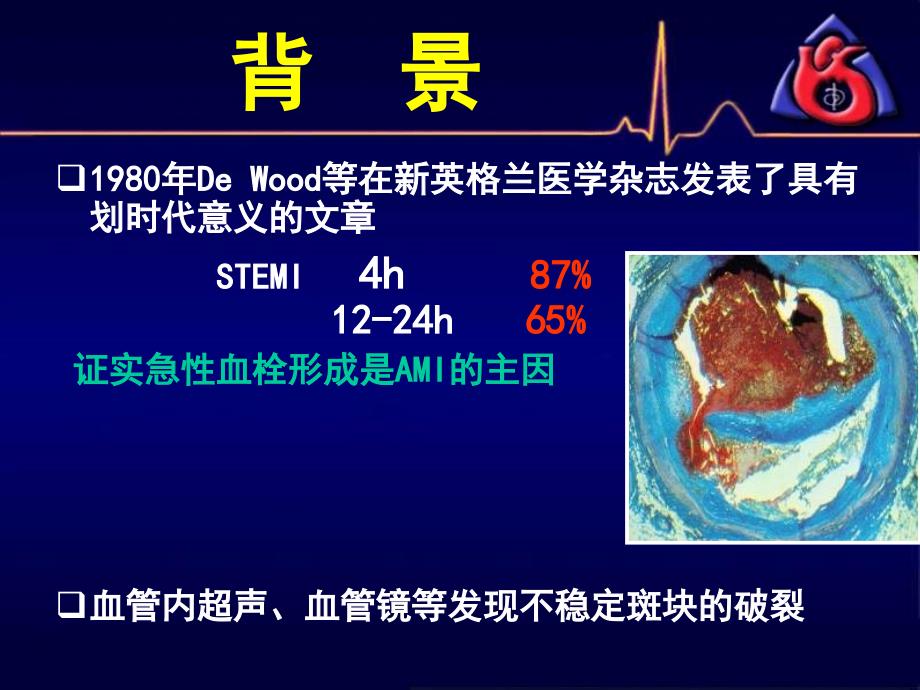 冠心病抗栓治疗葛均波_第2页