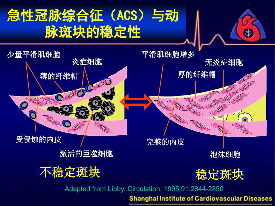 冠心病抗栓治疗葛均波_第3页