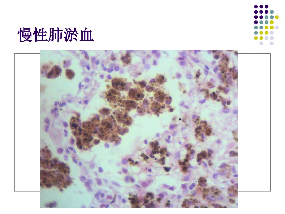 病理标本切片观察高职精要课件_第2页