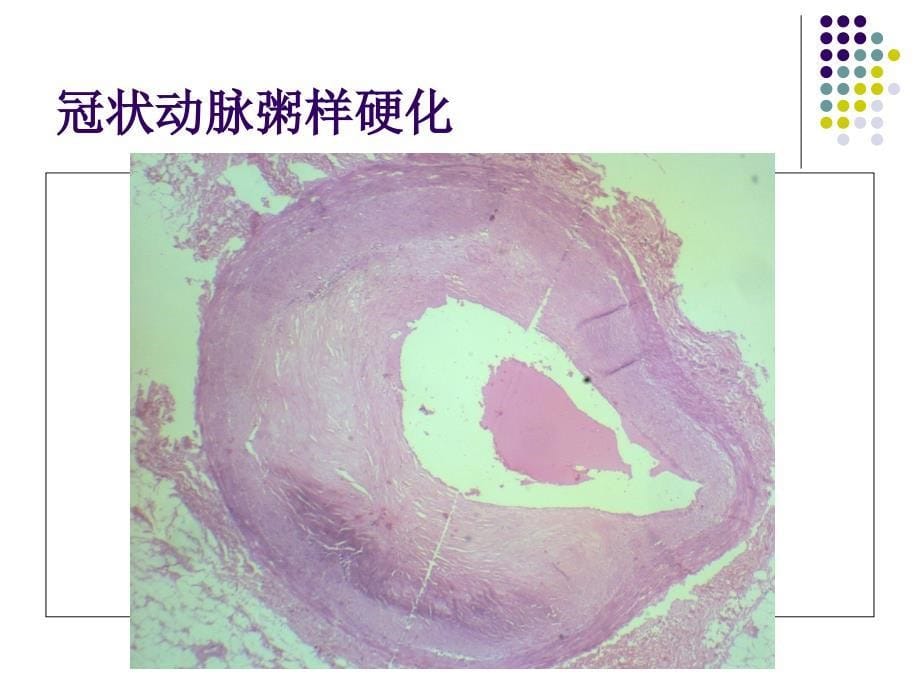 病理标本切片观察高职精要课件_第5页