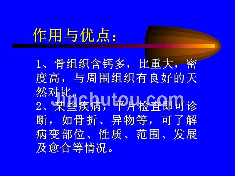 讲学三骨与关节x线诊断课件_第2页