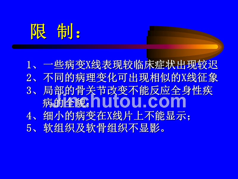 讲学三骨与关节x线诊断课件_第4页