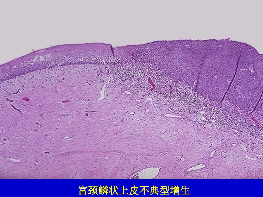 病理学实习镜下生殖系统ppt课件_第1页