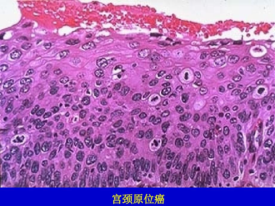 病理学实习镜下生殖系统ppt课件_第2页