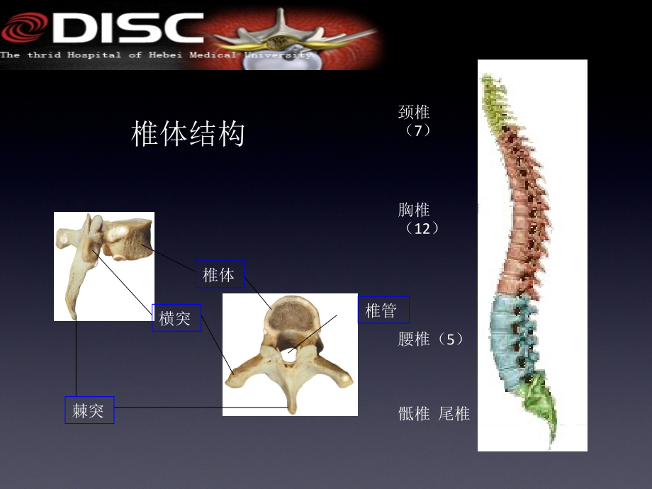 脊柱常见疾病与手术ppt课件_第4页