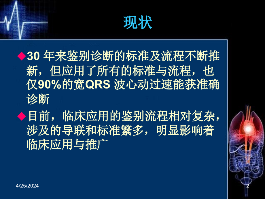 宽qrs波心动过速鉴别诊断新流程课件_第2页