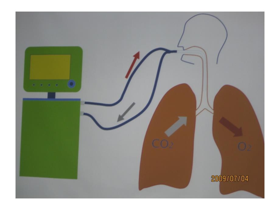 机械通气原理ppt课件_第3页