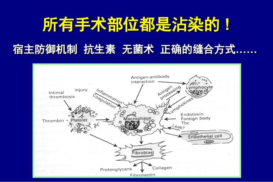 骨与关节感染邱贵兴教学课件幻灯_第5页