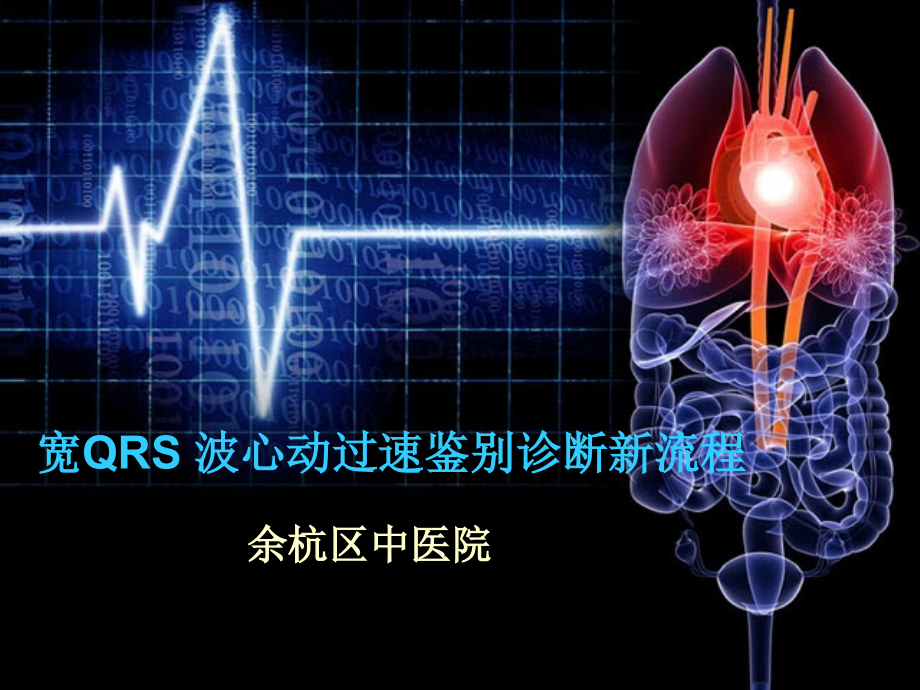 宽qrs波心动过速鉴别诊断新流程资料课件_第1页