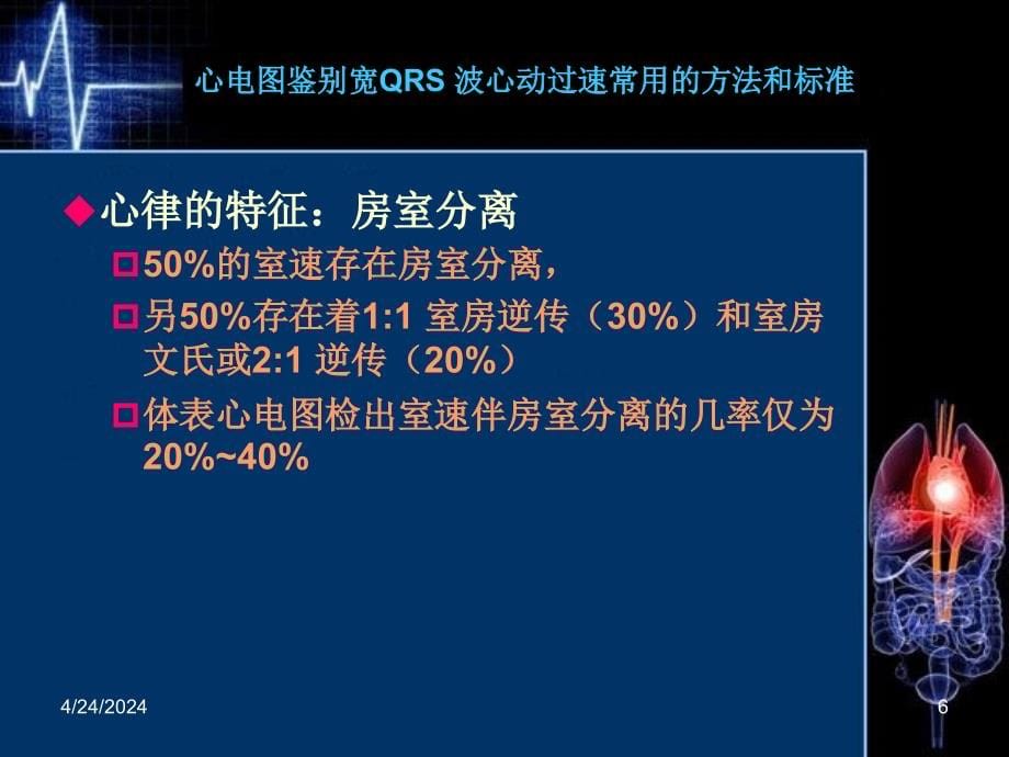 宽qrs波心动过速鉴别诊断新流程资料课件_第5页