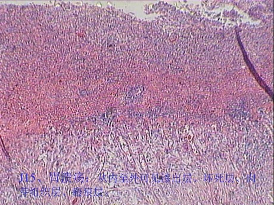 胃解剖及病理切片课件_第3页