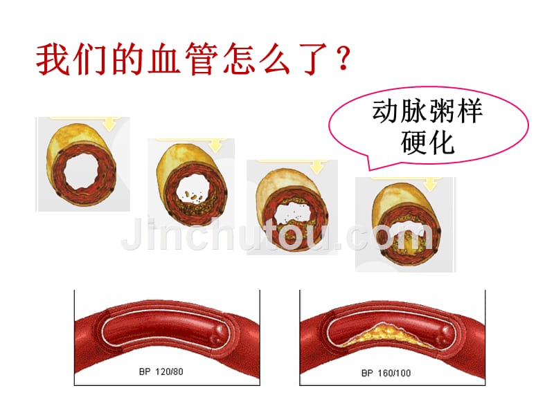 关注血脂关爱生命课件_第2页