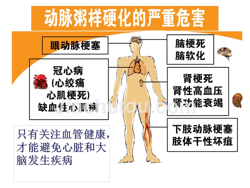 关注血脂关爱生命课件_第5页