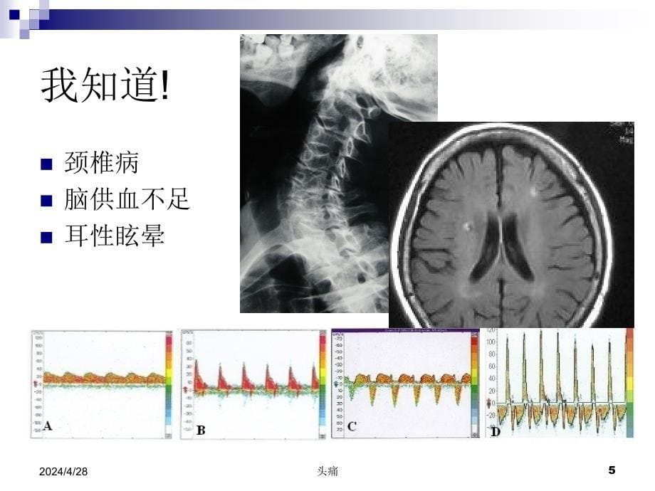 急诊医生如何应对眩晕患者课件_第5页